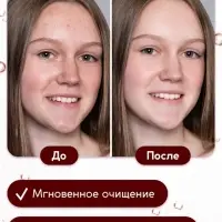 Гель для умывания очищающий SEMILY с АНА кислотами, 200 мл