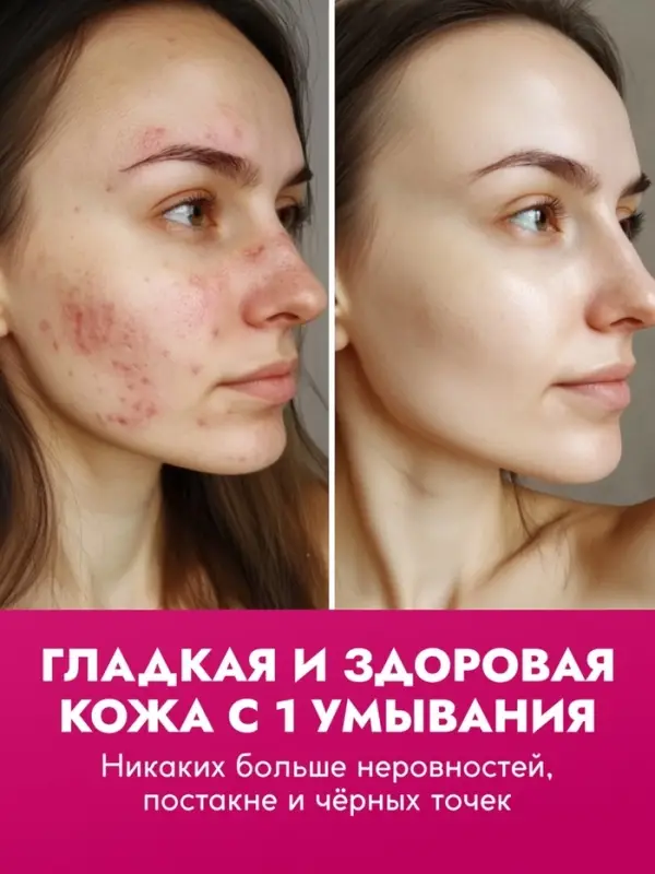 Пенка для умывания отшелушивающая SEMILY с кислотами, 150 мл