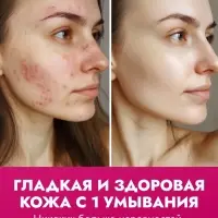 Пенка для умывания отшелушивающая SEMILY с кислотами, 150 мл