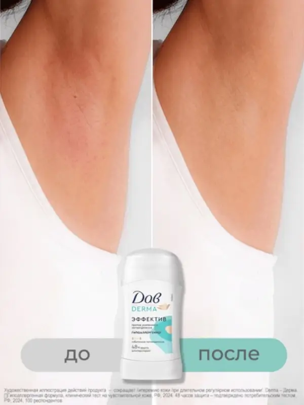 Дезодорант женский гипоаллергенный "Дав" против сильного пота, 40 мл