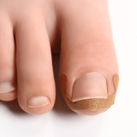 Набор наклеек для коррекции вросших ногтей, 8 шт, 5,2 &times; 2 см, цвет бежевый