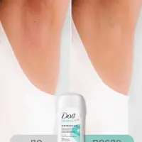 Дезодорант женский гипоаллергенный "Дав" против сильного пота, 40 мл