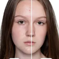 Гель для умывания очищающий SEMILY против акне, 200 мл