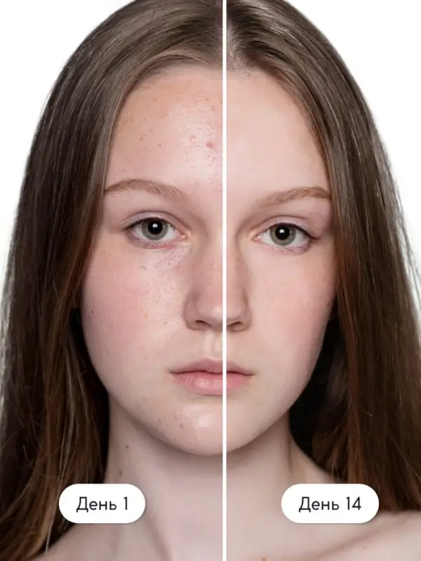 Гель для умывания очищающий SEMILY против акне, 200 мл