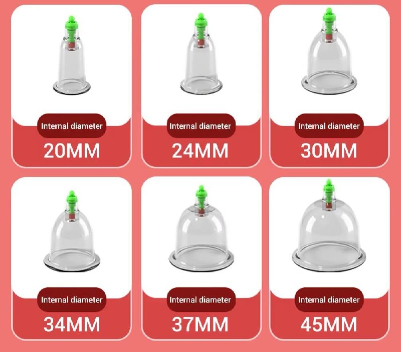 Электрический массажер-банки (цвет в ассортименте)